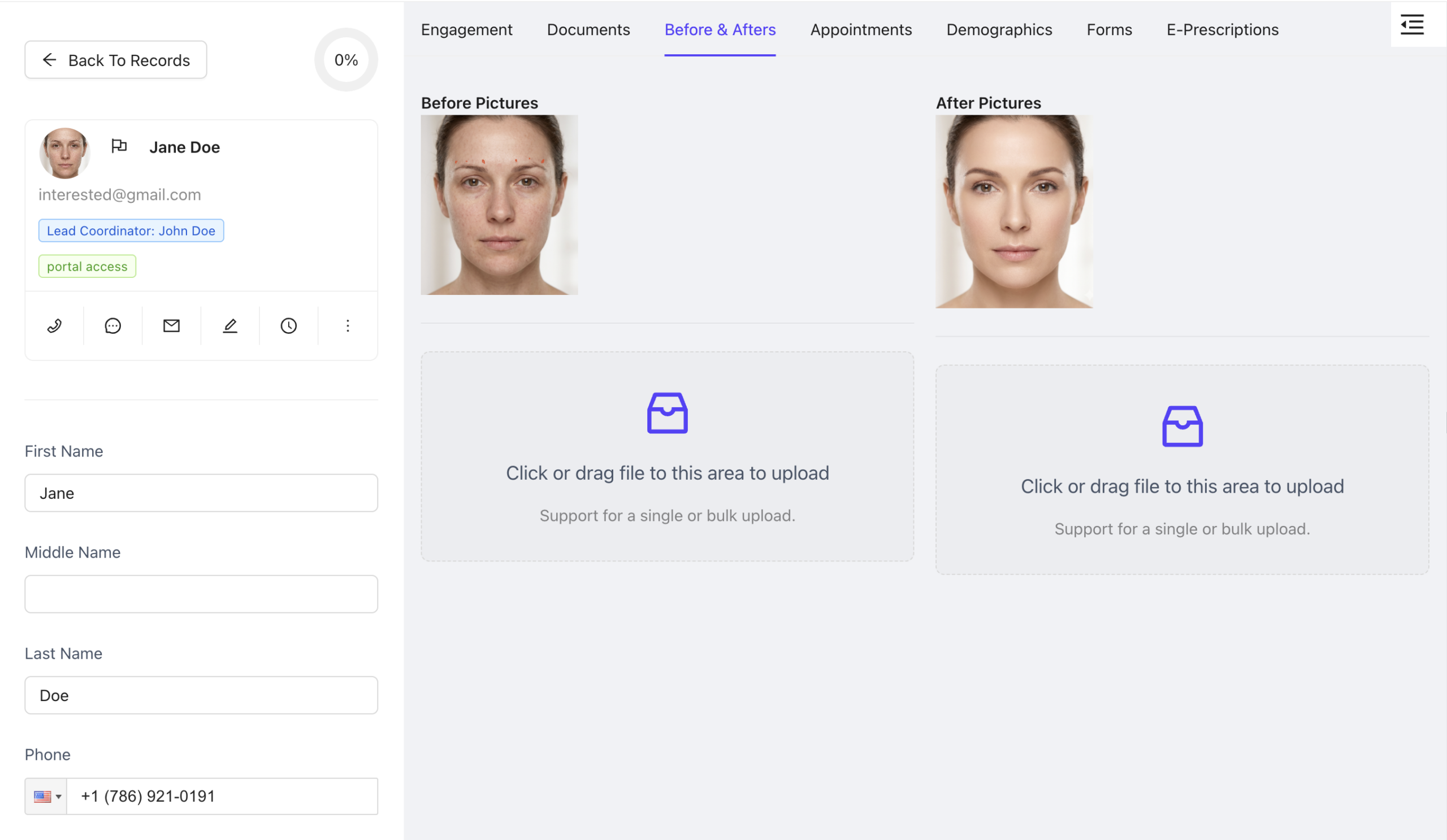 Patient Before & Afters